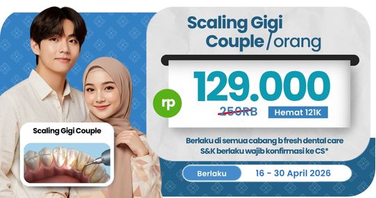 Scaling Gigi Couple